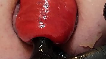 Play Contender For Biggest Prolapse (Male Warning!)
